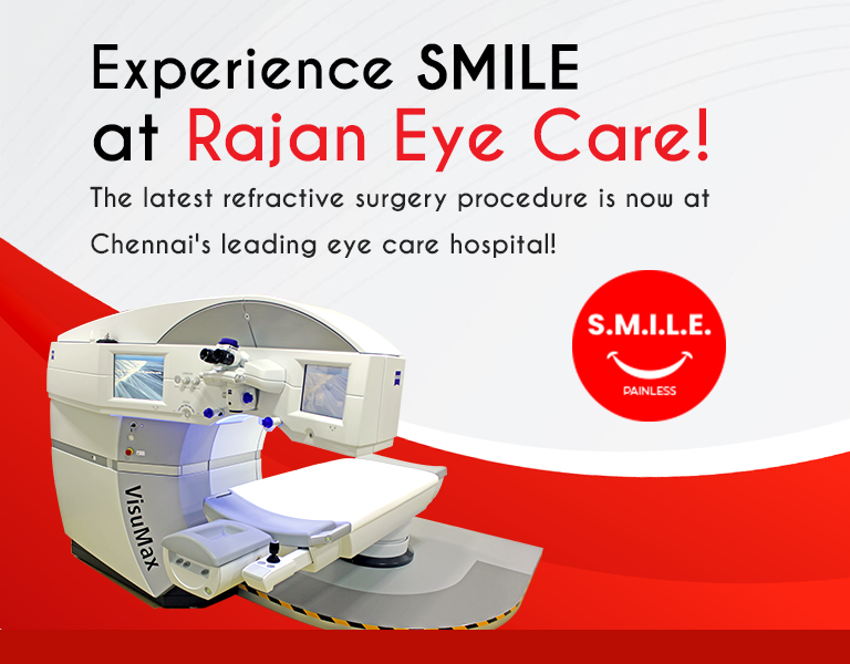best eye hospital in chennai